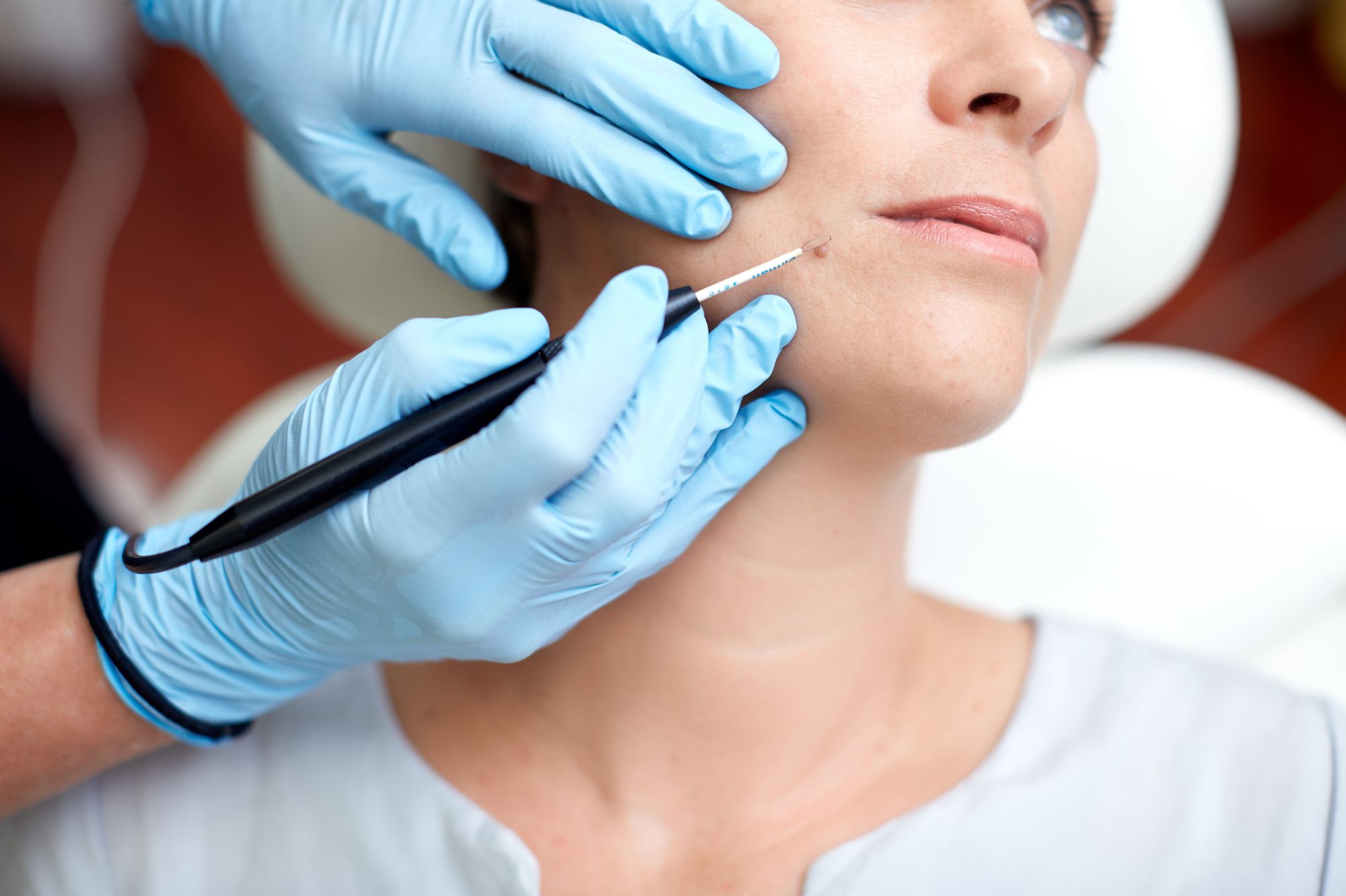 Clinic42 Treatment
