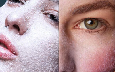 Winter Skin Secrets